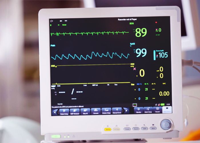 Monitor showing vital signs EKG, ECG Electrocardiographic